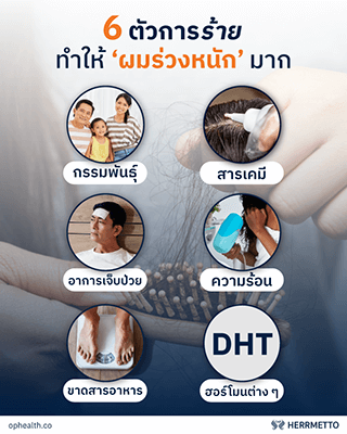 202105 25 SEO Rewrite ophealth.co ผมร่วงเยอะมาก รักษายังไงดี 02 O&P Hair Care ผลิตภัณฑ์ดูแลเส้นผม