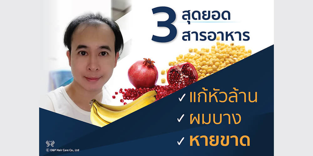 3 สุดยอดสารอาหาร รักษาผมร่วง