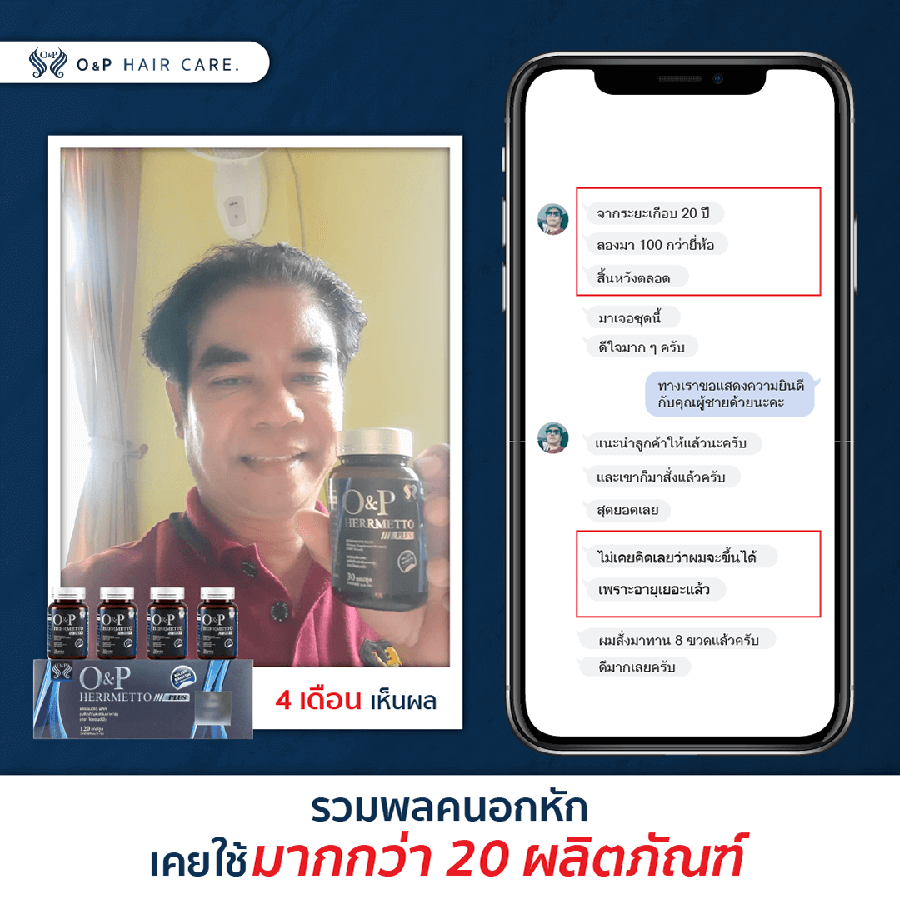 ยาปลูกผมช่วยให้ผมดกดำ ผมหนาขึ้น ผมร่วง ผมบาง หัวล้าน - 4