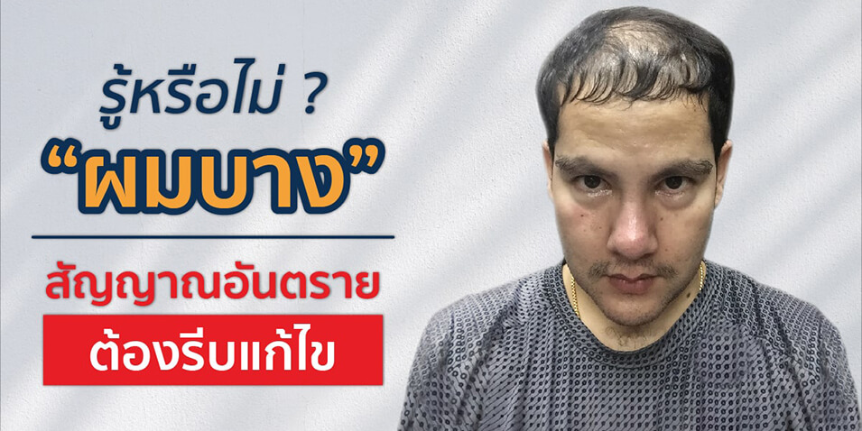 รู้หรือไม่ “ผมบาง” สัญญาณอันตรายต้องรีบแก้ไข