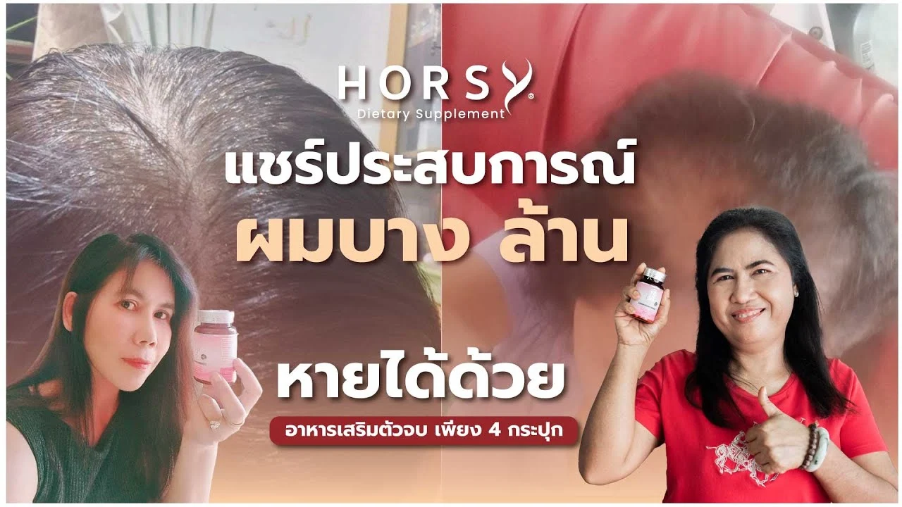 แชร์ประสบการณ์ ผู้หญิง 2 คน ที่ต้อง “ทนหัวล้าน” มาหลายปี | HORSY